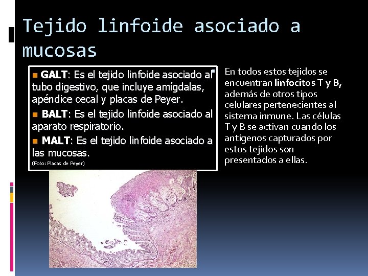 Tejido linfoide asociado a mucosas GALT: Es el tejido linfoide asociado al tubo digestivo, Tejido linfoide asociado a mucosas GALT: Es el tejido linfoide asociado al tubo digestivo,