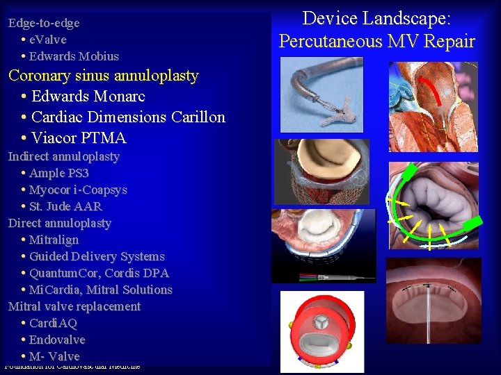Edge-to-edge • e. Valve • Edwards Mobius Coronary sinus annuloplasty • Edwards Monarc •