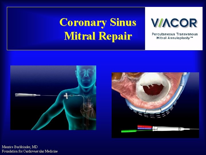 Coronary Sinus Mitral Repair Maurice Buchbinder, MD Foundation for Cardiovascular Medicine 