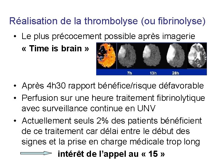 Réalisation de la thrombolyse (ou fibrinolyse) • Le plus précocement possible après imagerie «