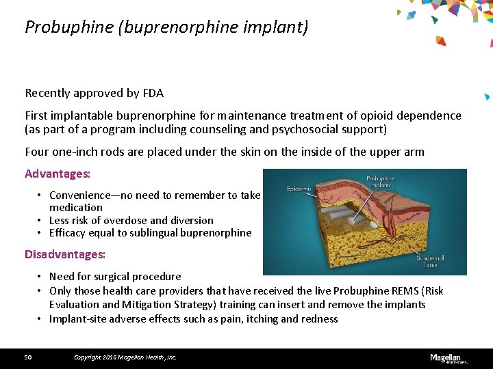 Probuphine (buprenorphine implant) Recently approved by FDA First implantable buprenorphine for maintenance treatment of