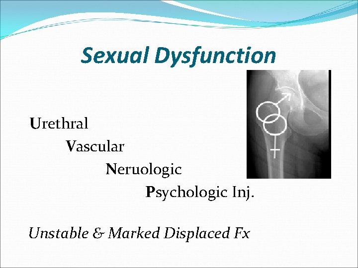 Sexual Dysfunction Urethral Vascular Neruologic Psychologic Inj. Unstable & Marked Displaced Fx 