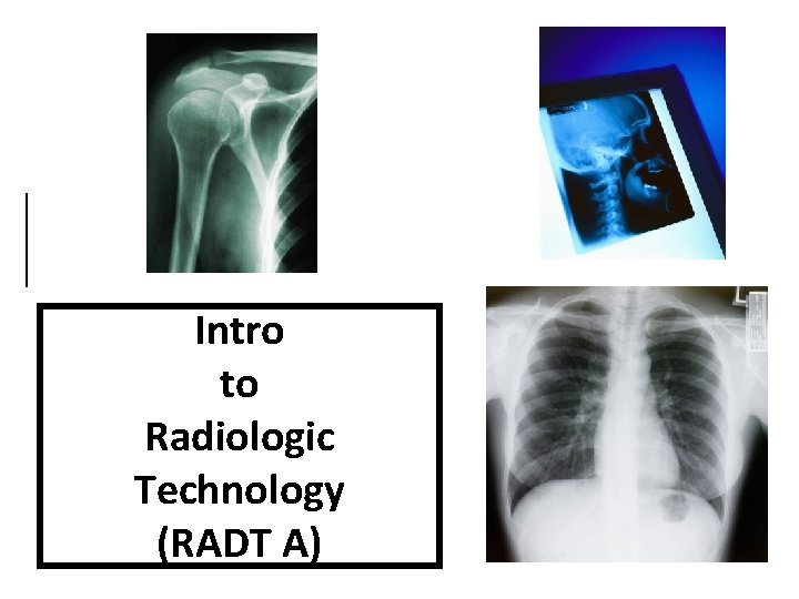 Intro to Radiologic Technology (RADT A) 