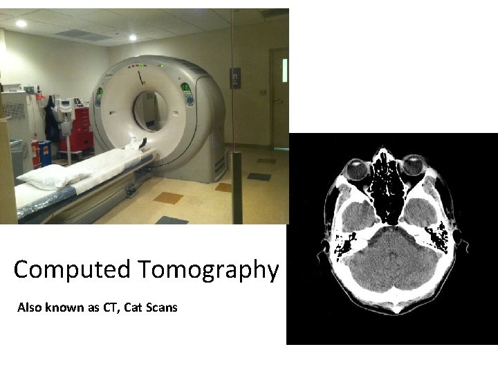 Computed Tomography Also known as CT, Cat Scans 