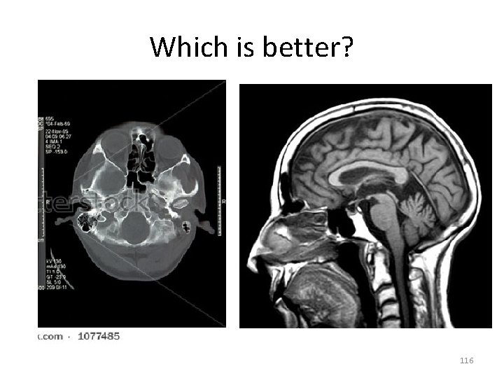 Which is better? 116 