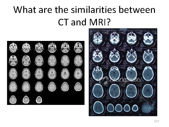 What are the similarities between CT and MRI? 117 