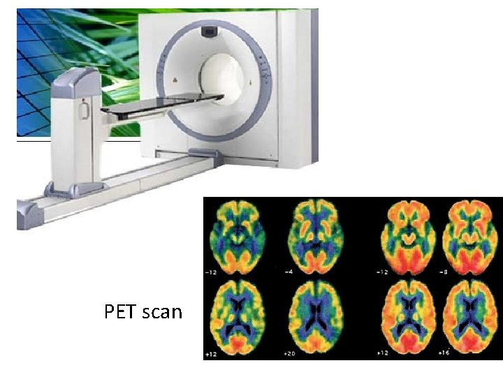 PET scan 