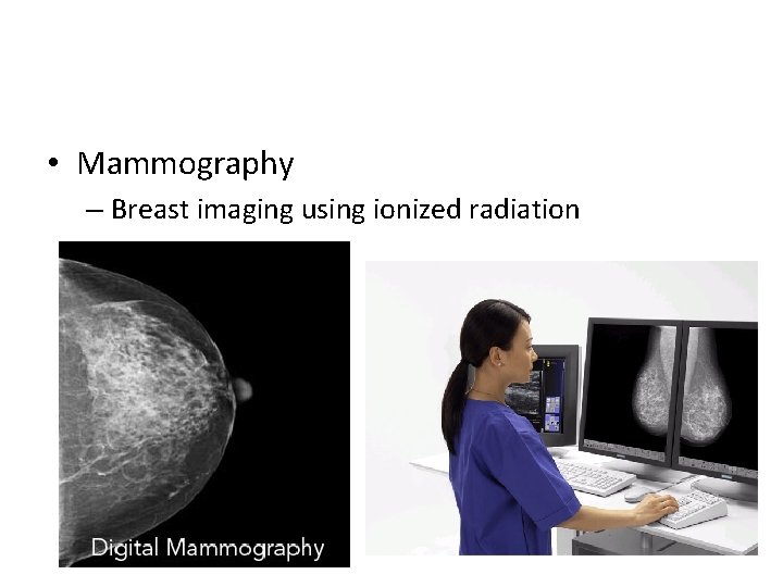  • Mammography – Breast imaging using ionized radiation 