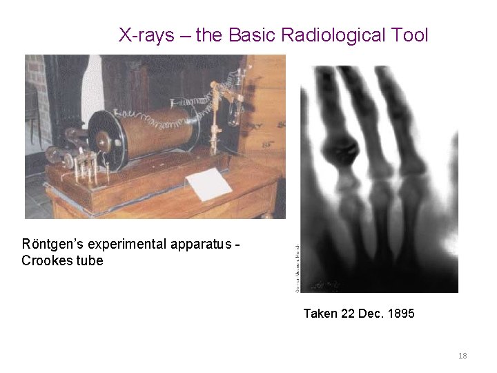 X-rays – the Basic Radiological Tool Röntgen’s experimental apparatus Crookes tube Taken 22 Dec.