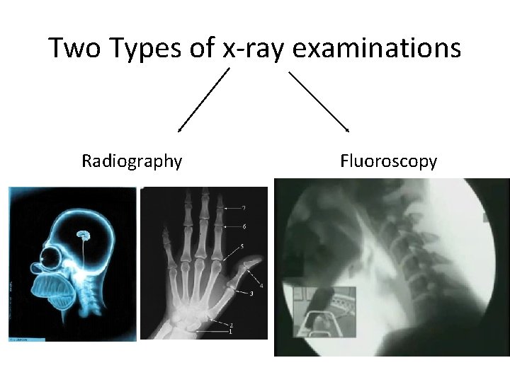 Two Types of x-ray examinations Radiography Fluoroscopy 