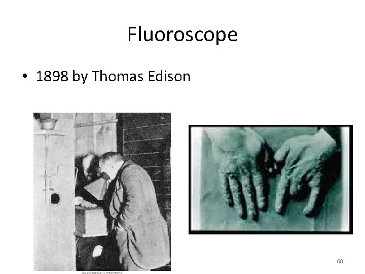 Fluoroscope • 1898 by Thomas Edison 60 