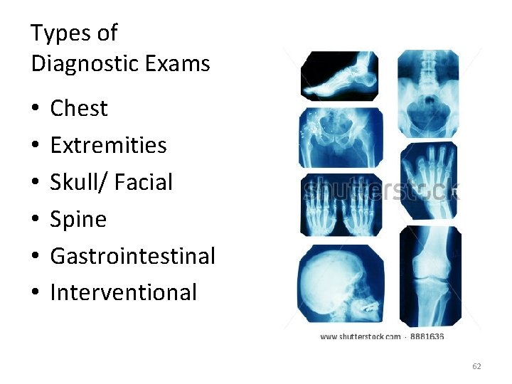 Types of Diagnostic Exams • • • Chest Extremities Skull/ Facial Spine Gastrointestinal Interventional
