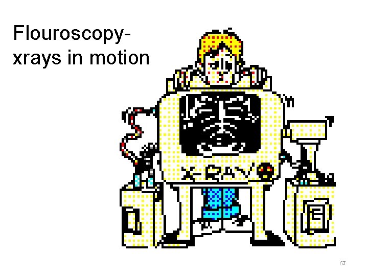 Flouroscopyxrays in motion 67 