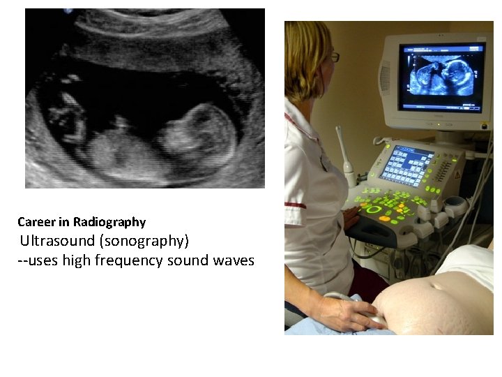 Career in Radiography Ultrasound (sonography) --uses high frequency sound waves 