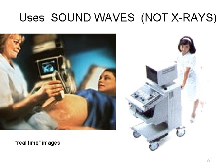 Uses SOUND WAVES (NOT X-RAYS) “real time” images 82 