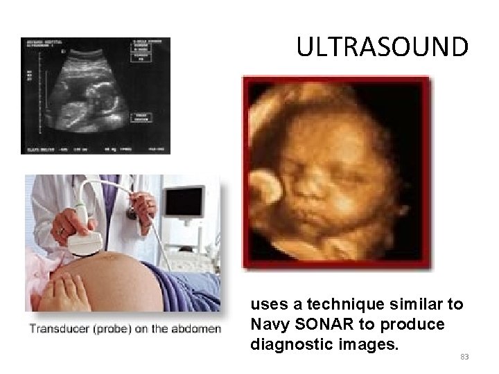 ULTRASOUND uses a technique similar to Navy SONAR to produce diagnostic images. 83 