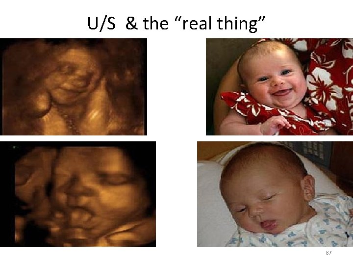 U/S & the “real thing” 87 