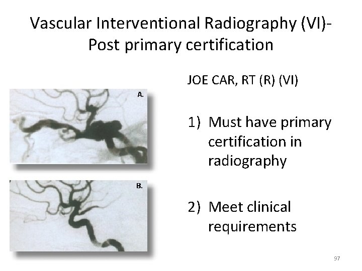 Vascular Interventional Radiography (VI)- Post primary certification JOE CAR, RT (R) (VI) 1) Must