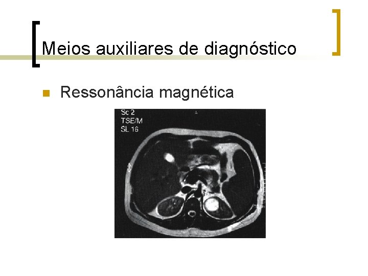 Meios auxiliares de diagnóstico n Ressonância magnética 