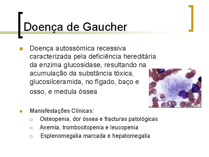 Doença de Gaucher n Doença autossómica recessiva caracterizada pela deficiência hereditária da enzima glucosidase,