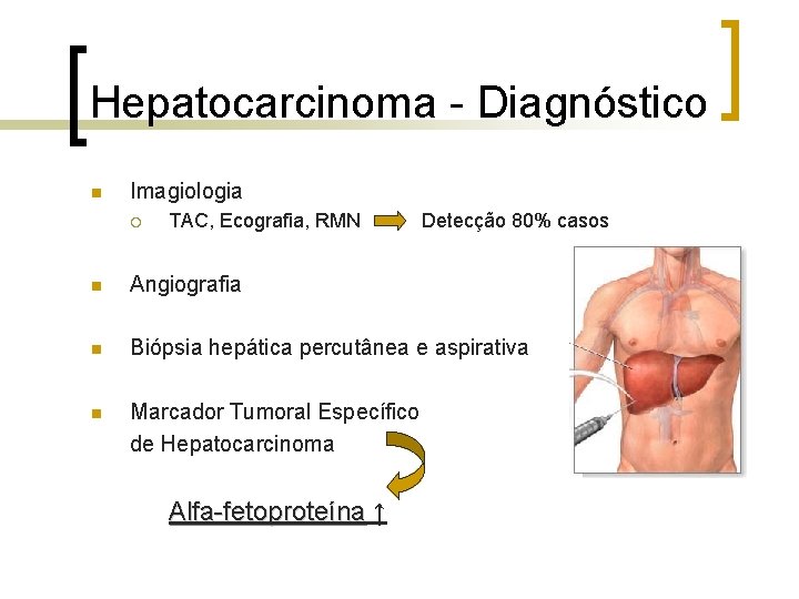 Hepatocarcinoma - Diagnóstico n Imagiologia ¡ TAC, Ecografia, RMN Detecção 80% casos n Angiografia