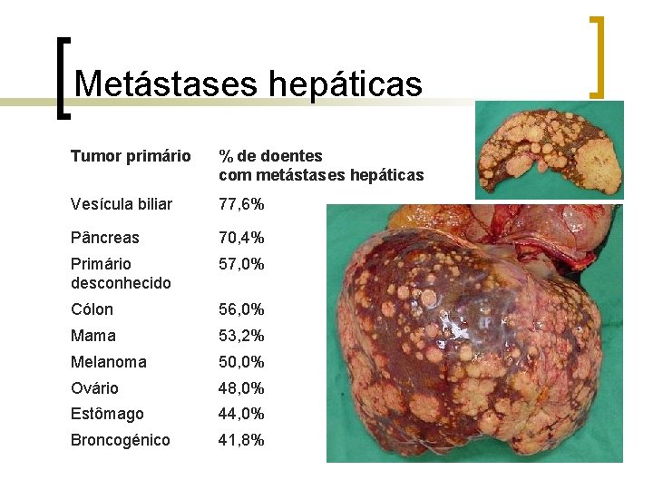 Metástases hepáticas Tumor primário % de doentes com metástases hepáticas Vesícula biliar 77, 6%