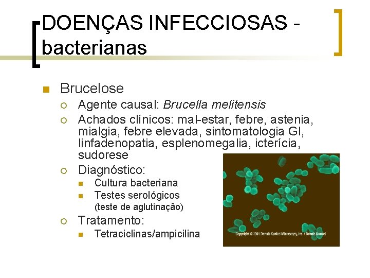 DOENÇAS INFECCIOSAS bacterianas n Brucelose ¡ ¡ ¡ Agente causal: Brucella melitensis Achados clínicos: