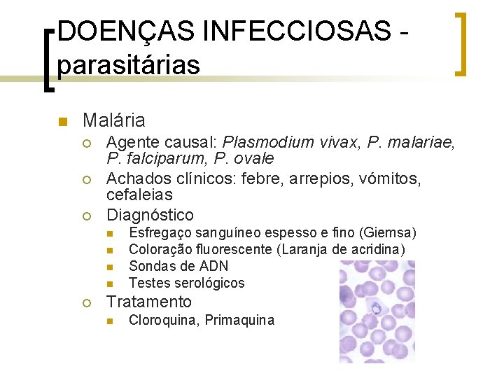 DOENÇAS INFECCIOSAS parasitárias n Malária ¡ ¡ ¡ Agente causal: Plasmodium vivax, P. malariae,