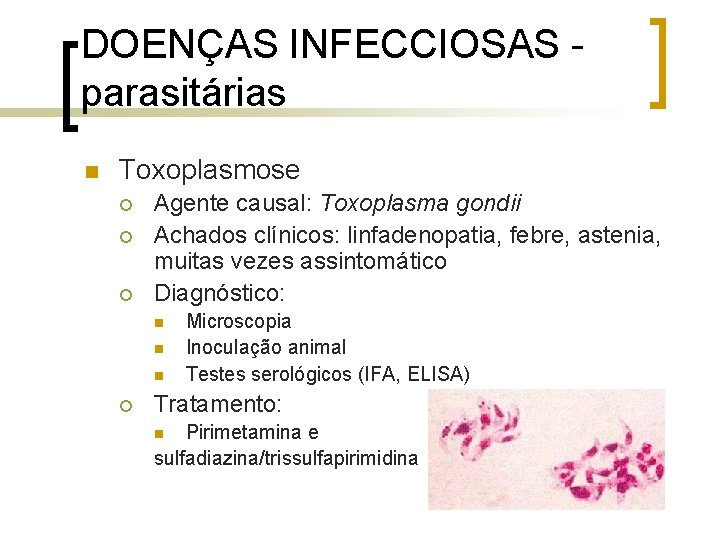 DOENÇAS INFECCIOSAS parasitárias n Toxoplasmose ¡ ¡ ¡ Agente causal: Toxoplasma gondii Achados clínicos: