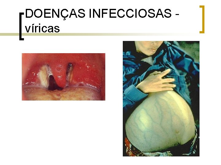 DOENÇAS INFECCIOSAS víricas 