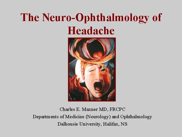 The Neuro-Ophthalmology of Headache Charles E. Maxner MD, FRCPC Departments of Medicine (Neurology) and
