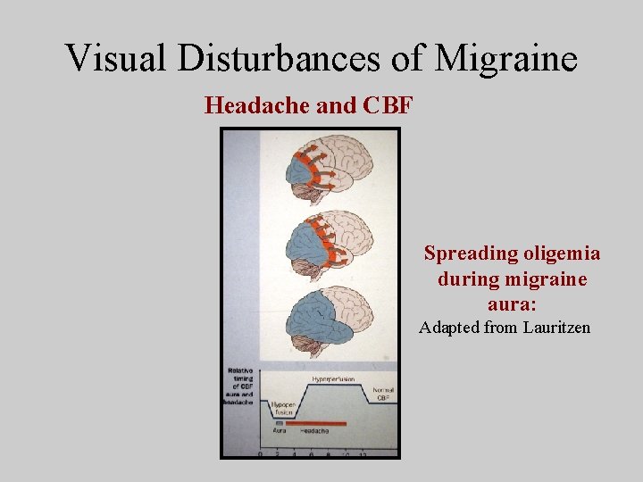 Visual Disturbances of Migraine Headache and CBF Spreading oligemia during migraine aura: Adapted from