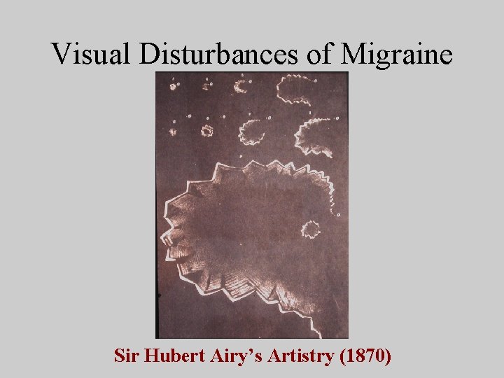 Visual Disturbances of Migraine Sir Hubert Airy’s Artistry (1870) 