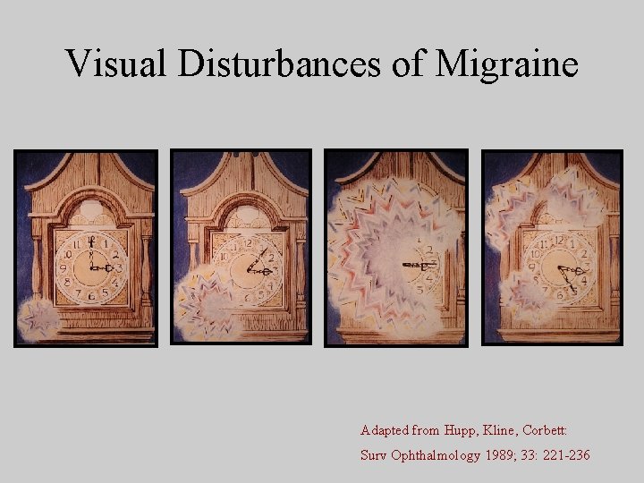 Visual Disturbances of Migraine Adapted from Hupp, Kline, Corbett: Surv Ophthalmology 1989; 33: 221