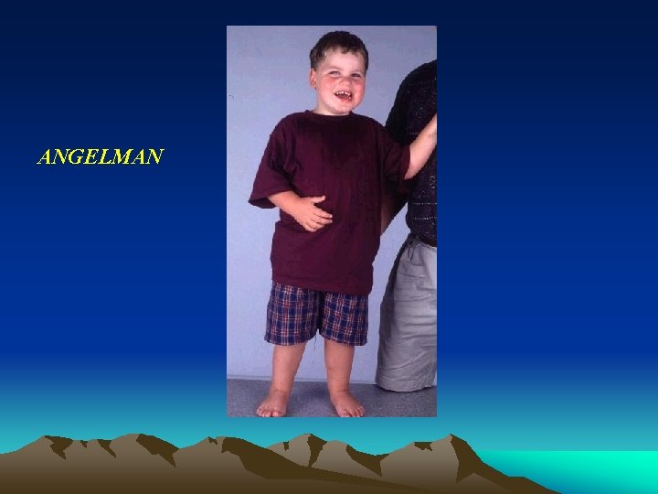 ANGELMAN ANGELMAN