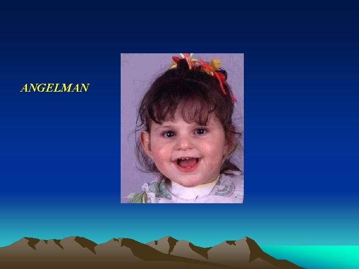 ANGELMAN ANGELMAN