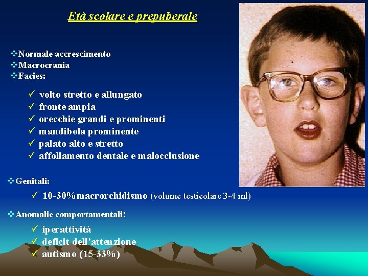 Età scolare e prepuberale v. Normale accrescimento v. Macrocrania v. Facies: ü volto stretto Età scolare e prepuberale v. Normale accrescimento v. Macrocrania v. Facies: ü volto stretto