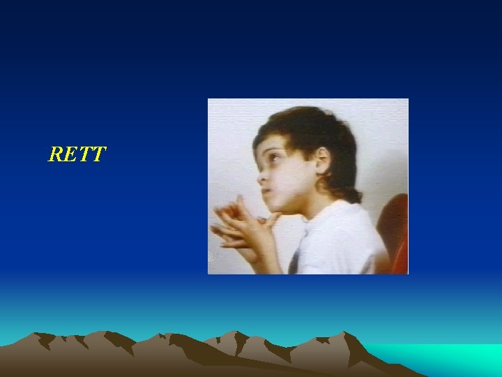 RETT RETT