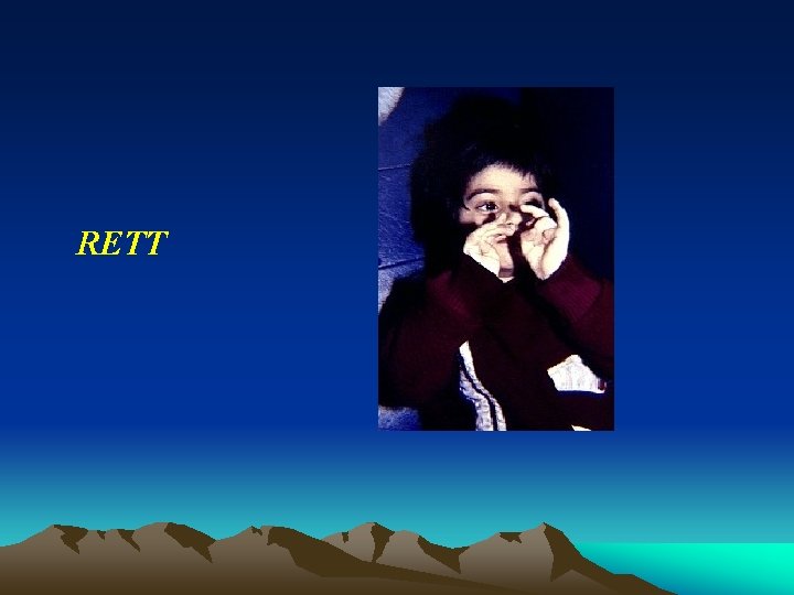 RETT RETT