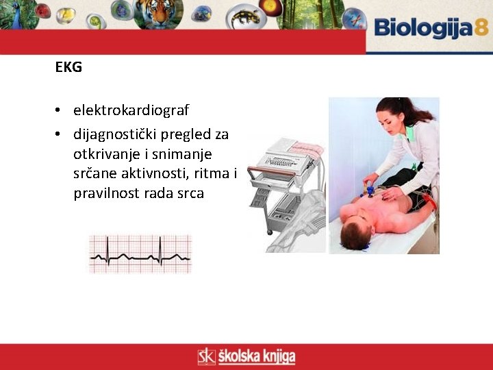 EKG • elektrokardiograf • dijagnostički pregled za otkrivanje i snimanje srčane aktivnosti, ritma i