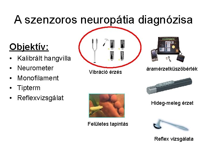 A szenzoros neuropátia diagnózisa Objektív: • • • Kalibrált hangvilla Neurometer Monofilament Tipterm Reflexvizsgálat