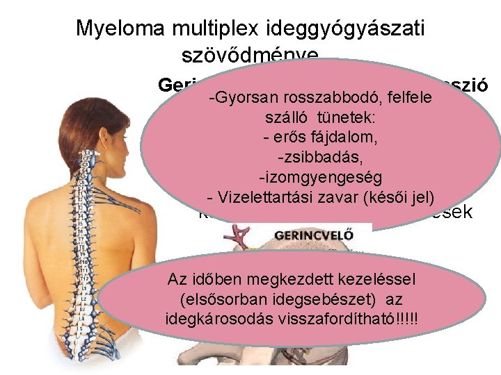 Myeloma multiplex ideggyógyászati szövődménye Gerincvelő vagy gyöki kompresszió -Gyorsan rosszabbodó, felfele (nyomás), szálló oka: