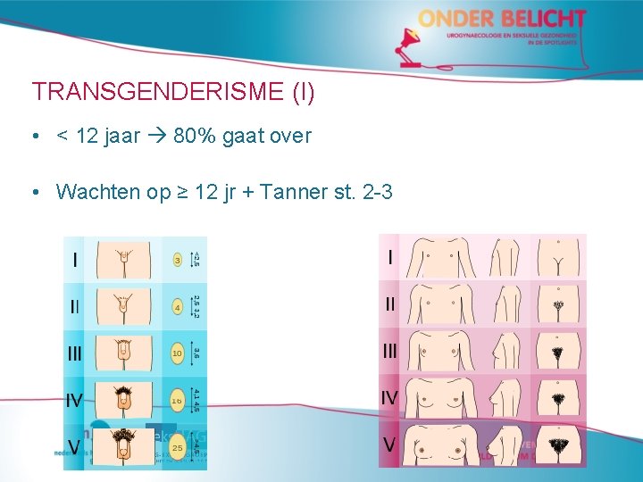 TRANSGENDERISME (I) • < 12 jaar 80% gaat over • Wachten op ≥ 12 TRANSGENDERISME (I) • < 12 jaar 80% gaat over • Wachten op ≥ 12