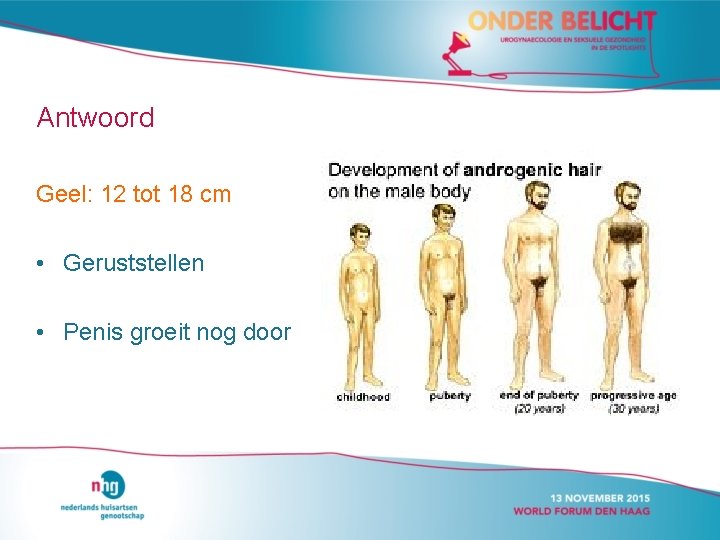 Antwoord Geel: 12 tot 18 cm • Geruststellen • Penis groeit nog door Antwoord Geel: 12 tot 18 cm • Geruststellen • Penis groeit nog door
