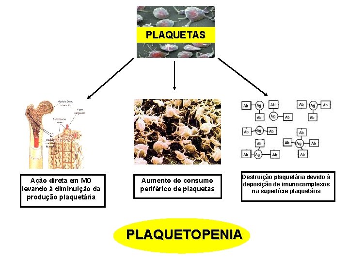 PLAQUETAS Ação direta em MO levando à diminuição da produção plaquetária Aumento do consumo PLAQUETAS Ação direta em MO levando à diminuição da produção plaquetária Aumento do consumo