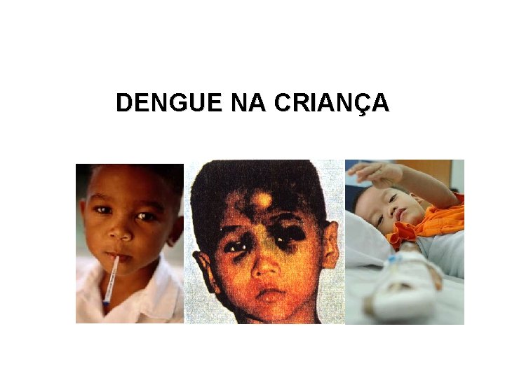 DENGUE NA CRIANÇA DENGUE NA CRIANÇA