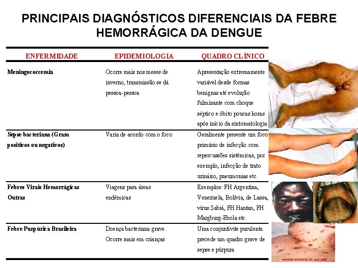 PRINCIPAIS DIAGNÓSTICOS DIFERENCIAIS DA FEBRE HEMORRÁGICA DA DENGUE ENFERMIDADE Meningococcemia EPIDEMIOLOGIA QUADRO CLÍNICO Ocorre PRINCIPAIS DIAGNÓSTICOS DIFERENCIAIS DA FEBRE HEMORRÁGICA DA DENGUE ENFERMIDADE Meningococcemia EPIDEMIOLOGIA QUADRO CLÍNICO Ocorre