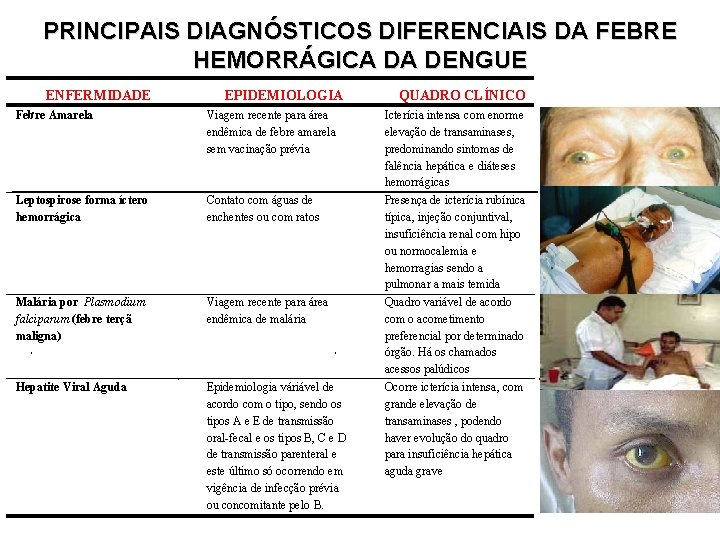 PRINCIPAIS DIAGNÓSTICOS DIFERENCIAIS DA FEBRE HEMORRÁGICA DA DENGUE ENFERMIDADE EPIDEMIOLOGIA Febre Amarela Viagem recente PRINCIPAIS DIAGNÓSTICOS DIFERENCIAIS DA FEBRE HEMORRÁGICA DA DENGUE ENFERMIDADE EPIDEMIOLOGIA Febre Amarela Viagem recente