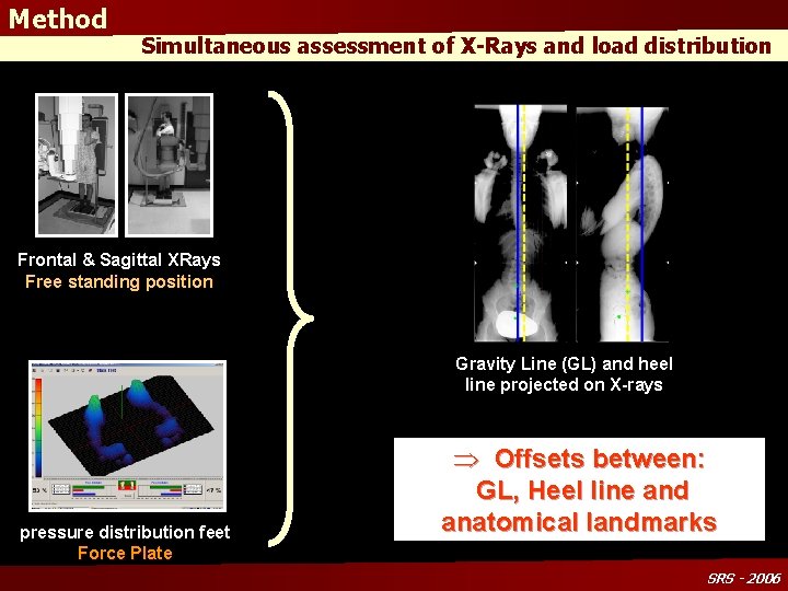 Method Simultaneous assessment of X-Rays and load distribution Frontal & Sagittal XRays Free standing