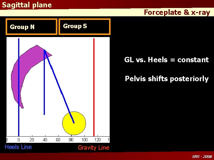 Sagittal plane Group N Forceplate & x-ray Group S GL vs. Heels = constant